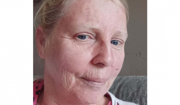 Deirdre Bonass' skin cancer story