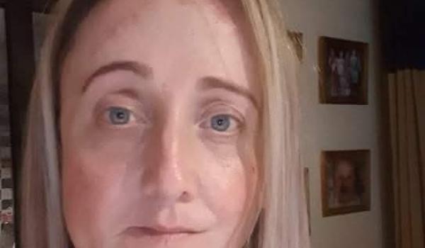 Liz Farrell's Skin Cancer Story