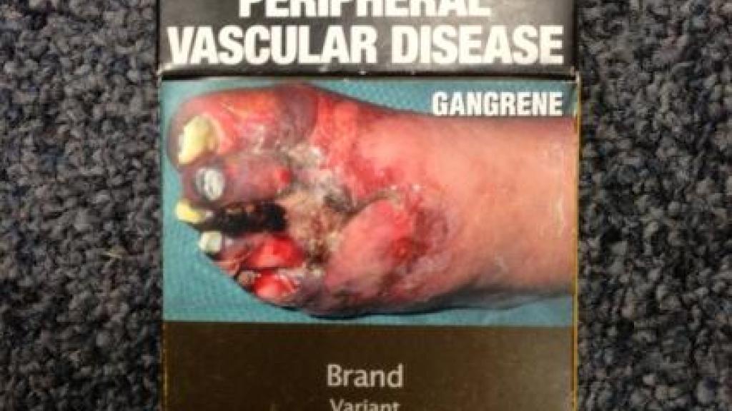 Health and Children’s charities reject Big Tobacco’s legal ultimatum and welcome further step towards plain packaging on shelves Health and Children’s charities reject Big Tobacco’s legal ultimatum and welcome further step towards plain packaging on shelves